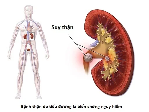 suy-than-man-tinh_161055381